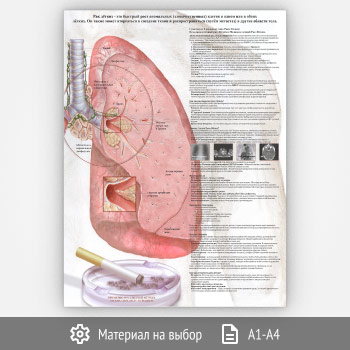 ������ ���� ������� (���-21, 1 ����)