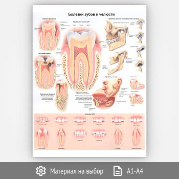 ������ �������� ����� � ������� (���-32, 1 ����)